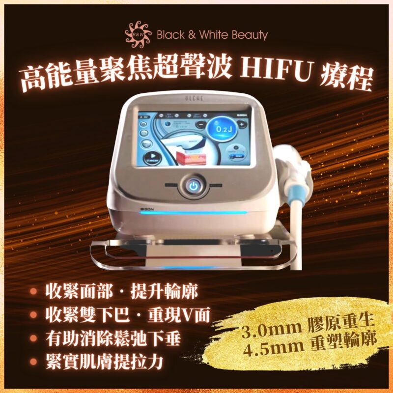 打造緊緻V面 高能量聚焦超聲波 HIFU 療程